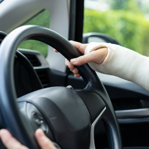 Driver with a cast on their arm for Louisiana work-related auto accident claims.